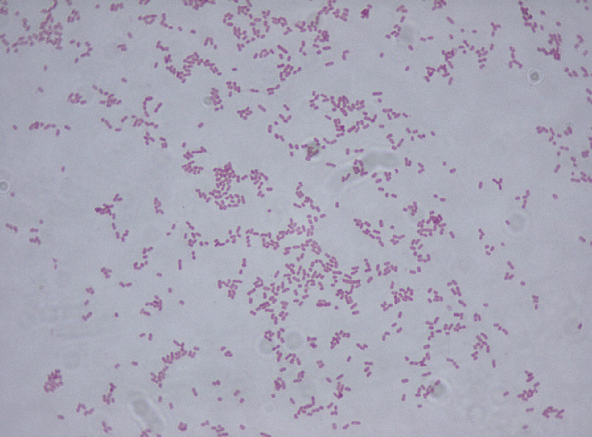 Imagem de referência relacionada a Klebsiella, item descrito como registro de referência sobre Klebsiella, organizado a partir de dados estruturados abertos