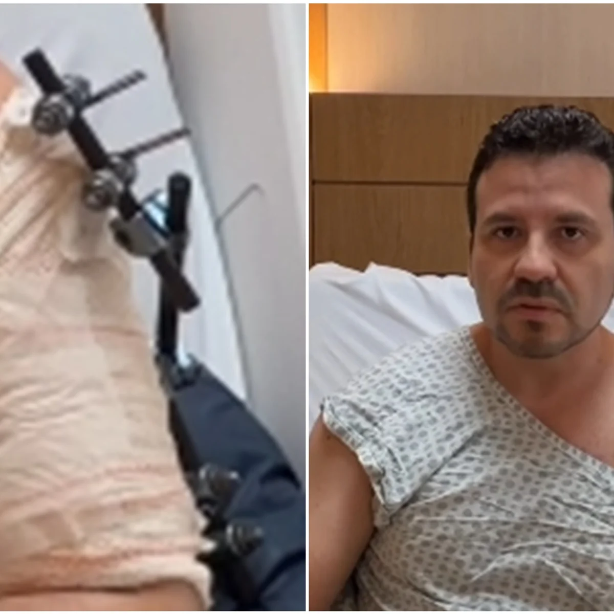 Médico em carro blindado cai em golpe do retrovisor e acaba baleado no Rio