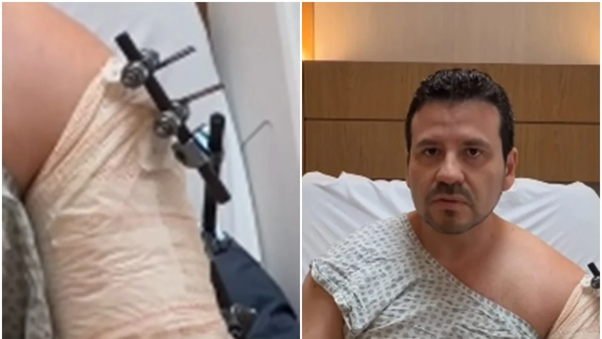 Médico em carro blindado cai em golpe do retrovisor e acaba baleado no Rio