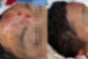 Ferimentos na cabeça do menino