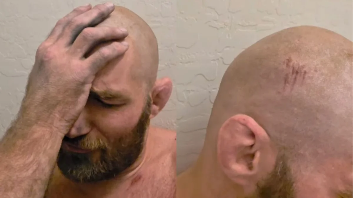 Campeão do UFC, Strickland é vítima de capotamento de carro e tem concussão