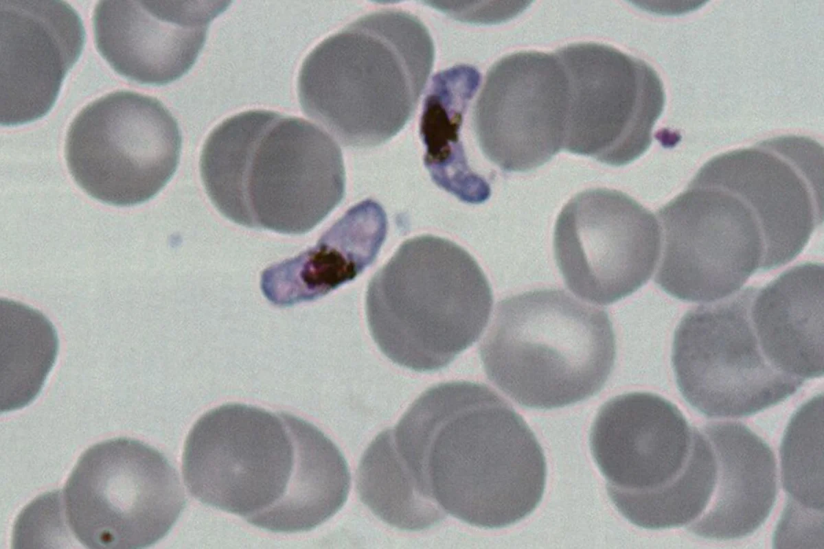 Foto miscroscópica e colorida de vírus da malária em um organismo vivo - Metrópoles.
