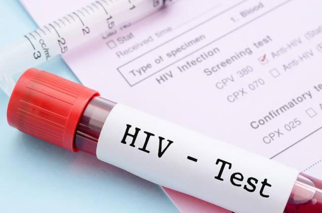 A AHF Jamaica alerta mais de 13.000 pessoas com HIV não documentadas no tratamento